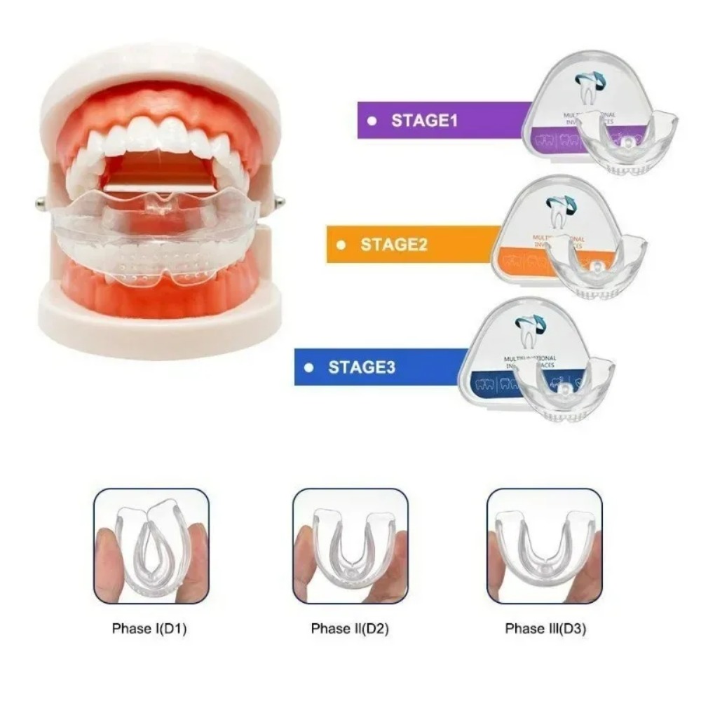 Teeth Whitening For Braces - Aparat ortodontyczny prostujący zęby, aparat dentystyczny,