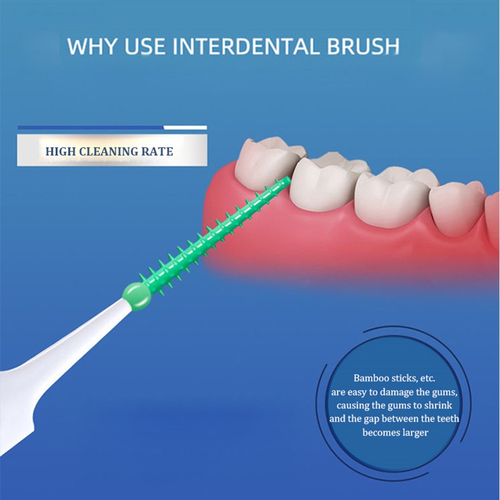 40~150 SZT. Silikonowe Szczote – Teeth Whitening For Braces recenzja i cena