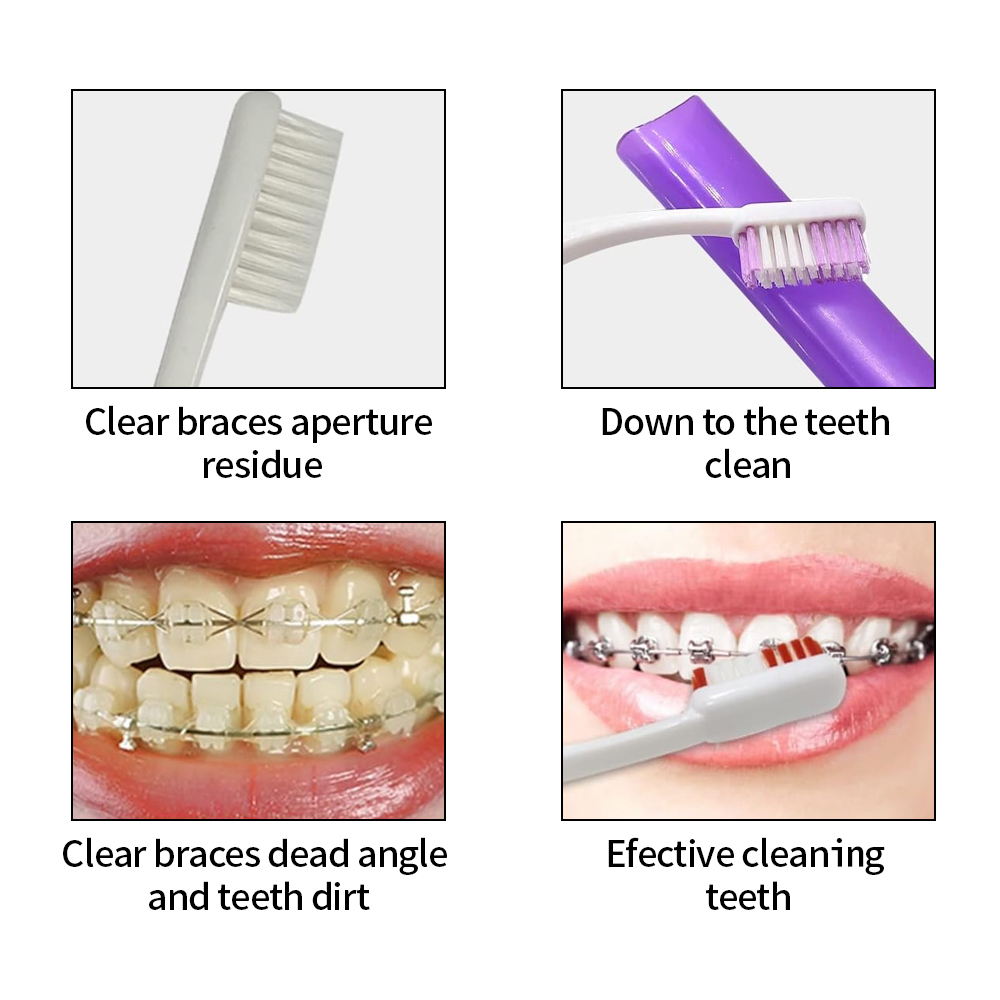 8 sztuk/zestaw zestaw szczotec – Teeth Whitening For Braces recenzja i cena