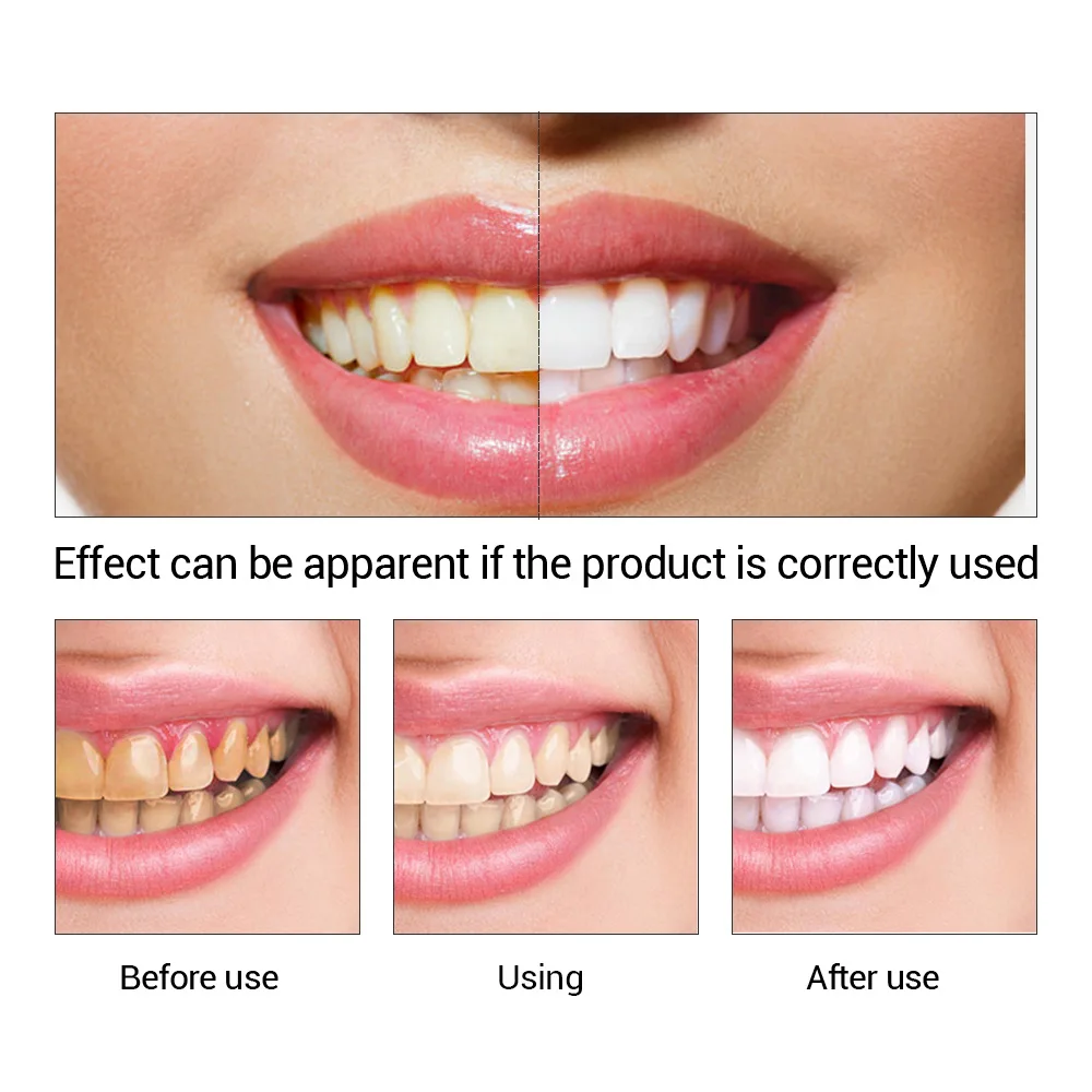 FTEENPLY esencja do wybielania – Teeth Whitening Natural recenzja i cena