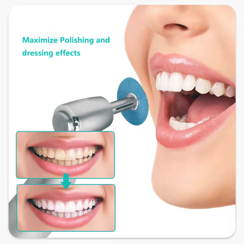 40 szt. Dyski polerskie dentys – Whitening Teeth Dentist recenzja i cena