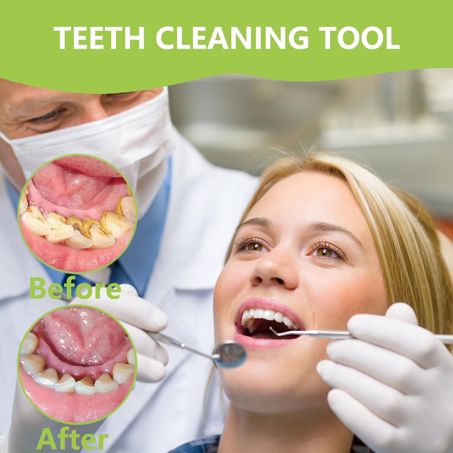 Profesjonalny zestaw do higien – Teeth Whitening Machine Professional recenzja i cena