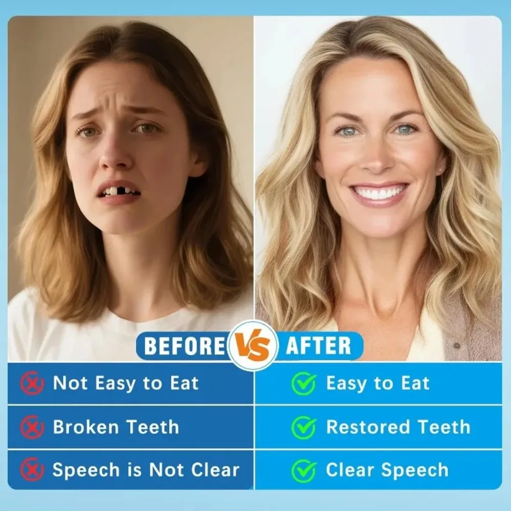 Pełny zestaw protez, sztuczne  – Teeth Whitening For Braces recenzja i cena