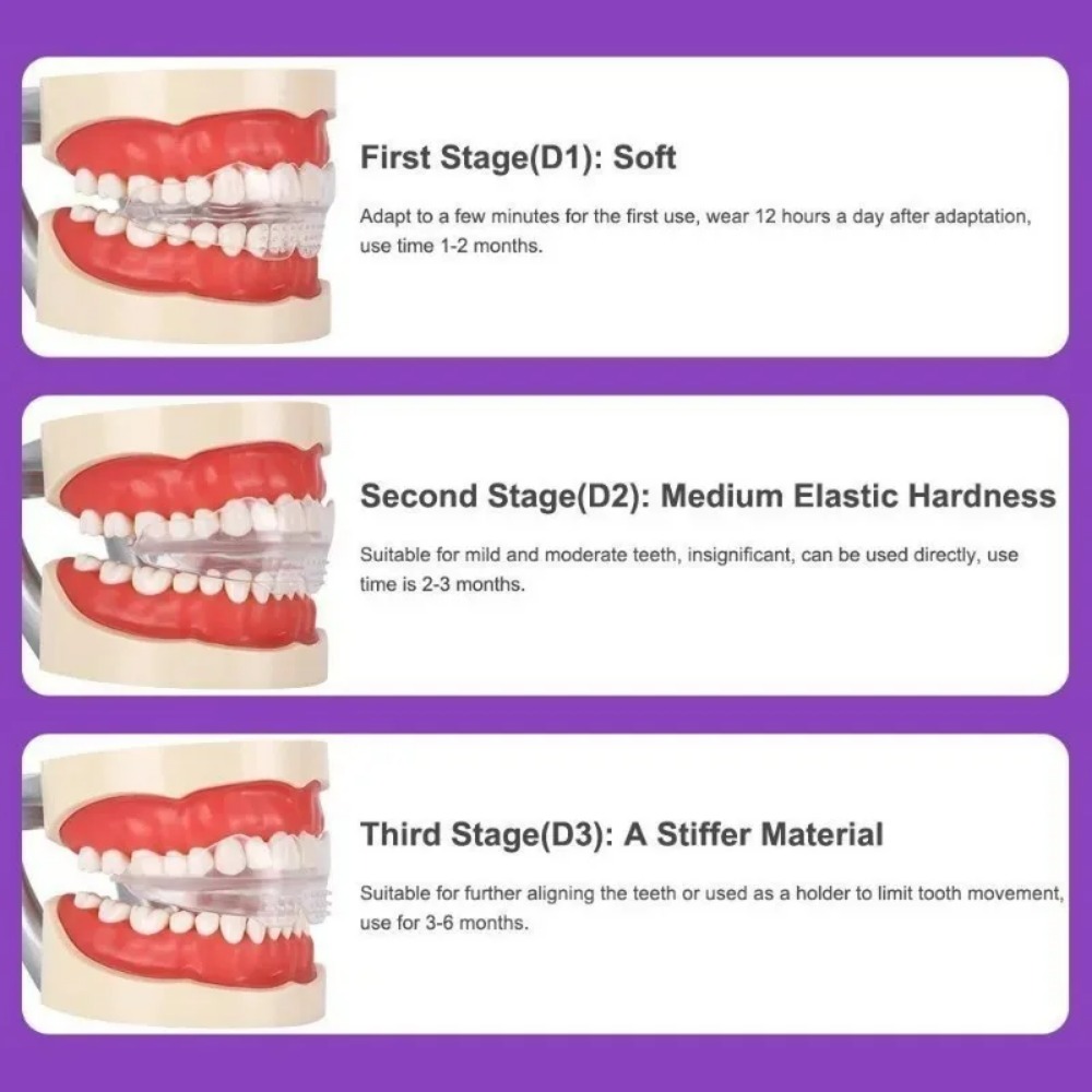 Aparat ortodontyczny prostując – Teeth Whitening For Braces recenzja i cena